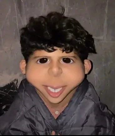 العبطلي اليمن - خوك الصغير 