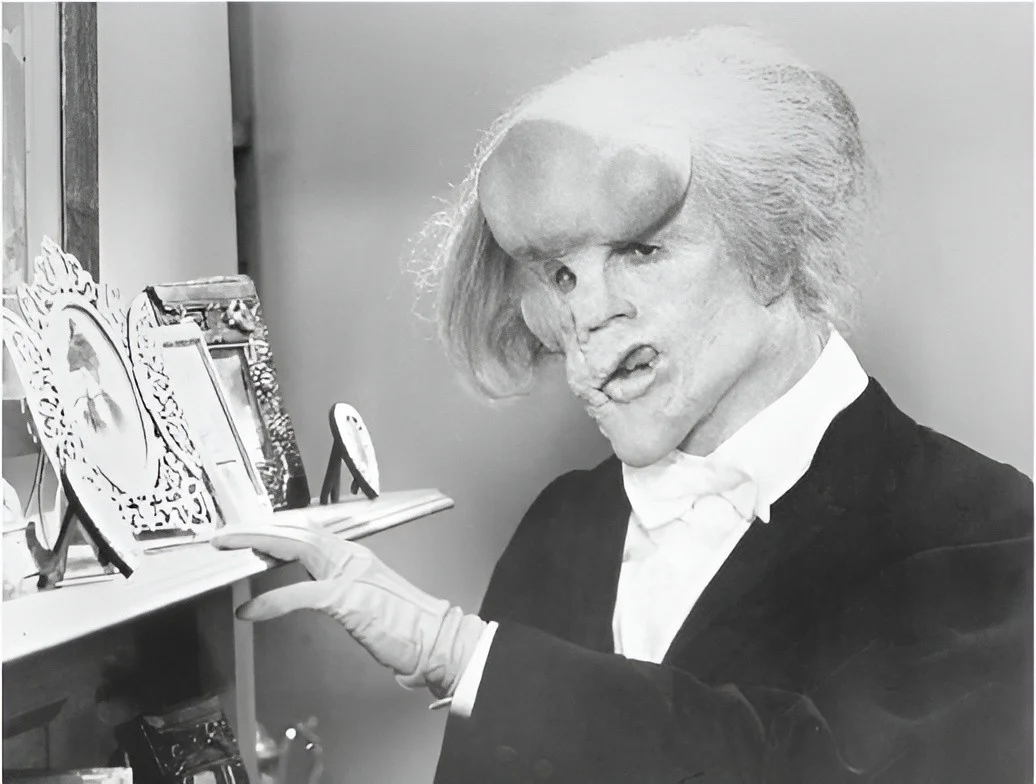 Elephant Man/John Merrick (Elephant Man)
