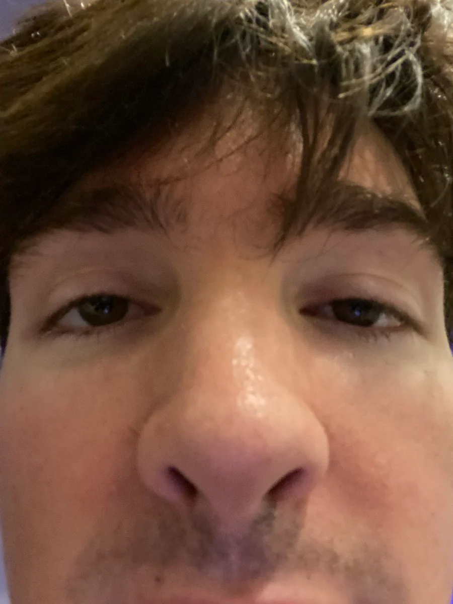 Albert