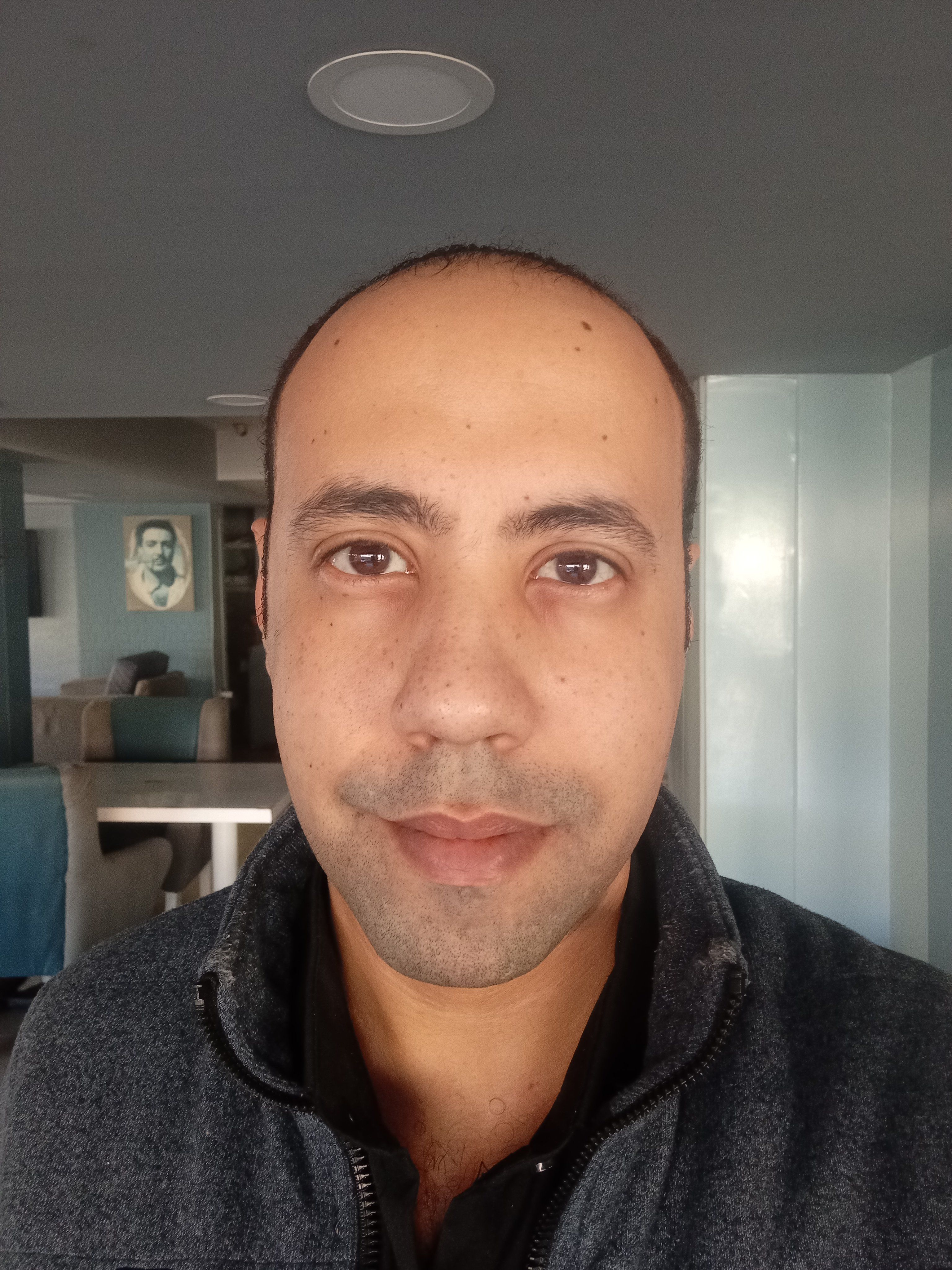 LoRA Training Image