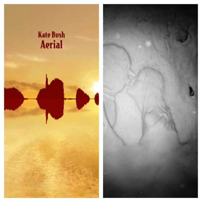 Kate Bush (Aerial + 50 Words For Snow Eras)